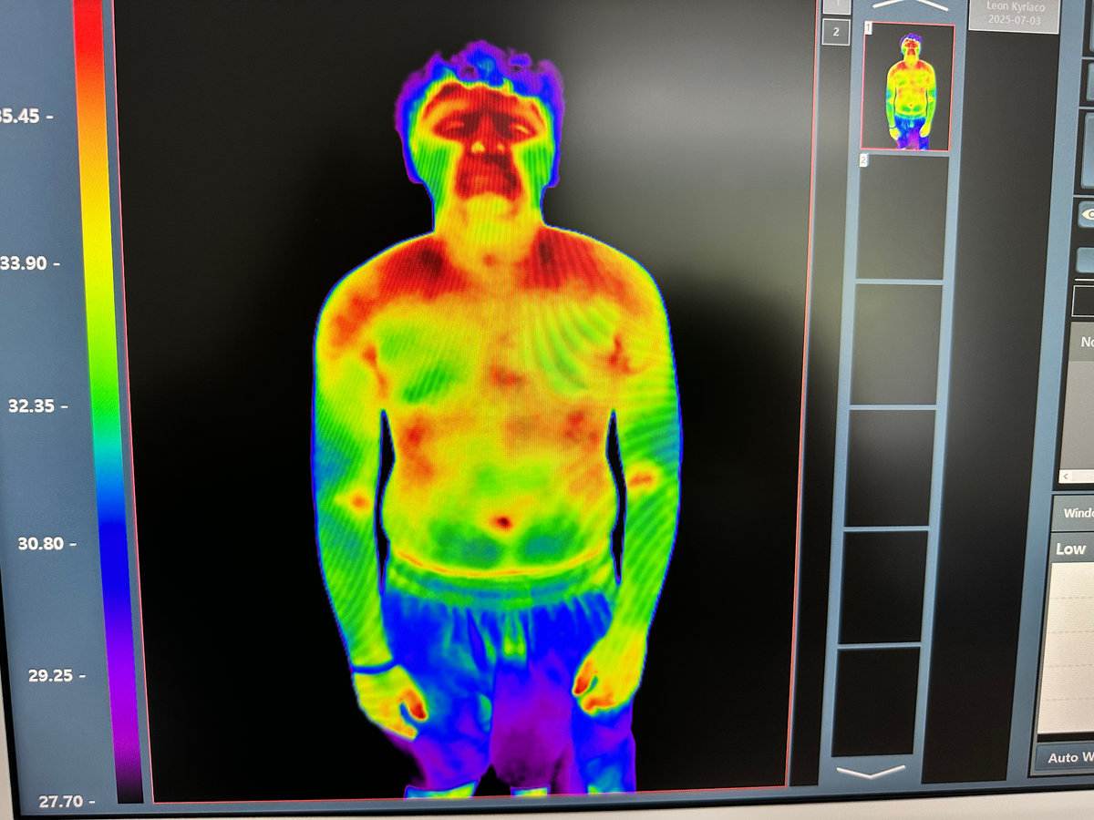 Infrared Thermal Imaging Full Body Scan
